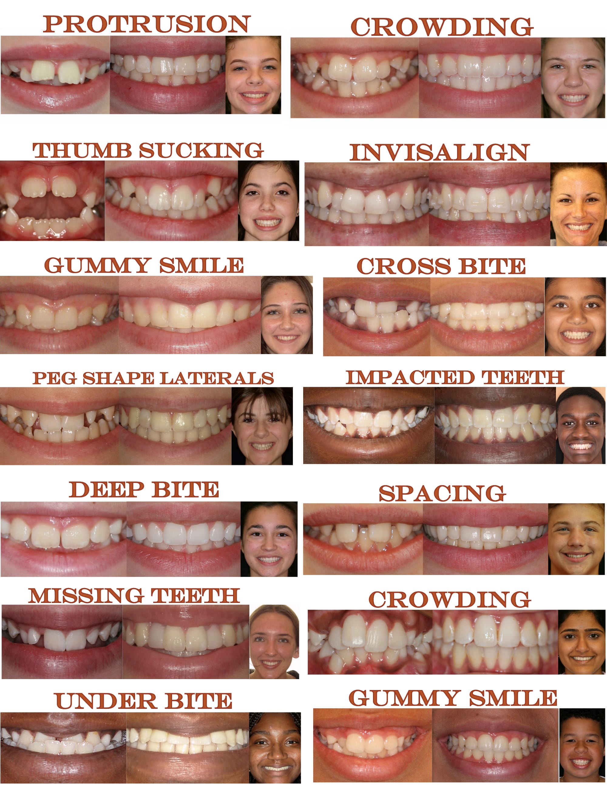 A collage of Dr. Zahedi's orthodontic patients before and after treatment with braces.